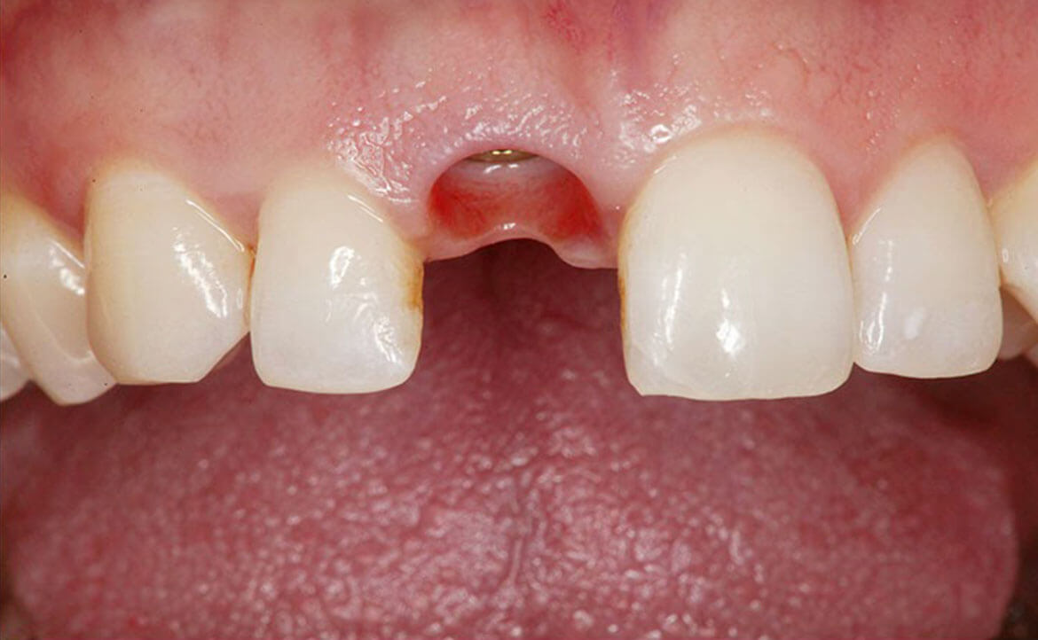 teeth before